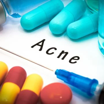 האם Triamcinolone Acetonide לאקנה טוב